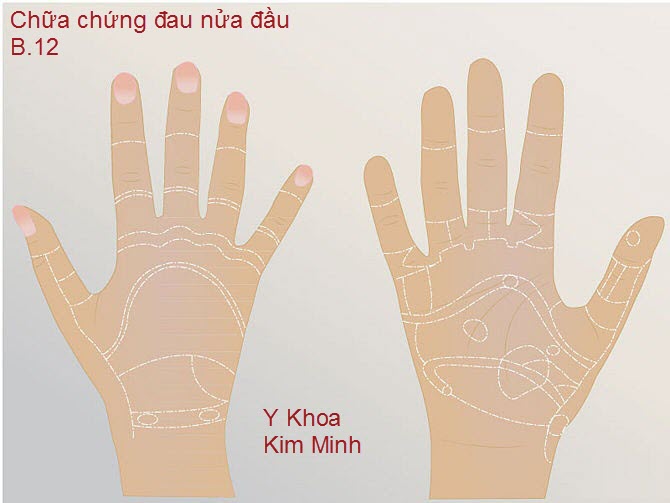 Chữa chứng đau nửa đầu, đốt sống cổ, cột sống bằng day huyệt b&agrave;n tay