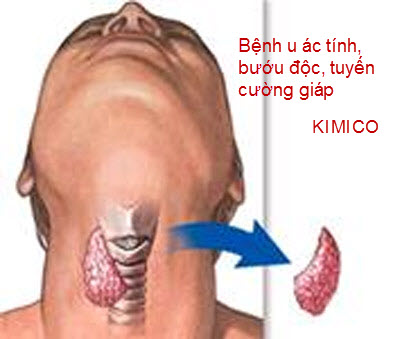Những bài thuốc hay chữa bệnh không ai ngờ đến P.1