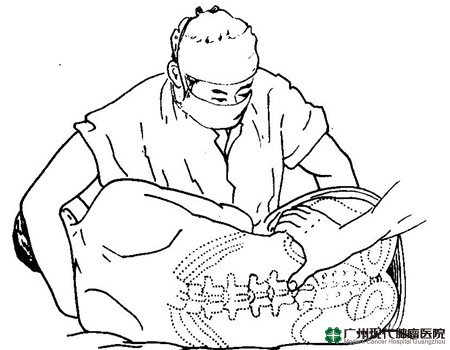 giường k&eacute;o gi&atilde;n cột sống v&agrave; phương ph&aacute;p điều trị