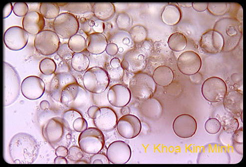 Yếu tố g&acirc;y ra cellulite