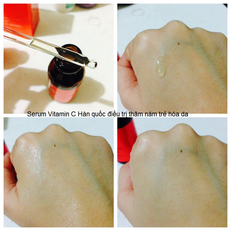 B&aacute;n serum vitanin C trị th&acirc;m n&aacute;m trẻ h&oacute;a da H&agrave;n Quốc Korea Y Khoa Kim Minh
