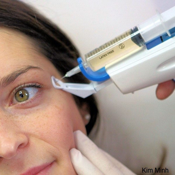 B&aacute;n s&uacute;ng bơm mỹ phẩm tế b&agrave;o gốc v&agrave;o da Y Khoa Kim Minh