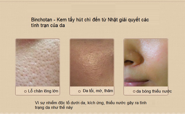 Binchotan san pham kem hut chi nhat ban y khoa kim minh ban tai tp hochiminh