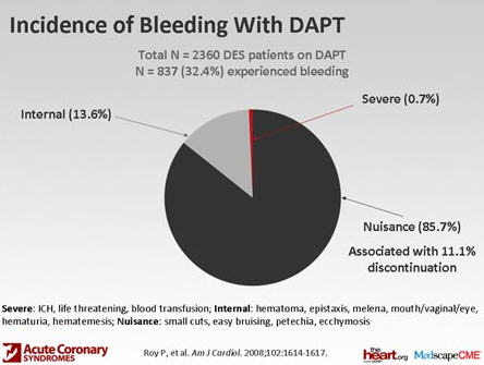 nhoi mau co tim va benh dot quy may do huyet ap