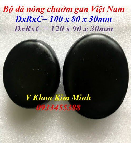 Bộ đá nóng chờm gan Viêt Nam bán tại Y Khoa Kim Minh 0933455388
