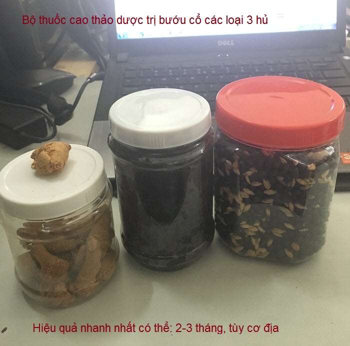 Thuoc dac tri buou co gia truyen Kim Minh