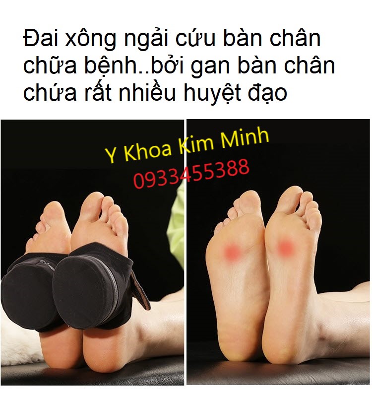 Đai xông nhang ngải cứu bàn chân chữa bệnh