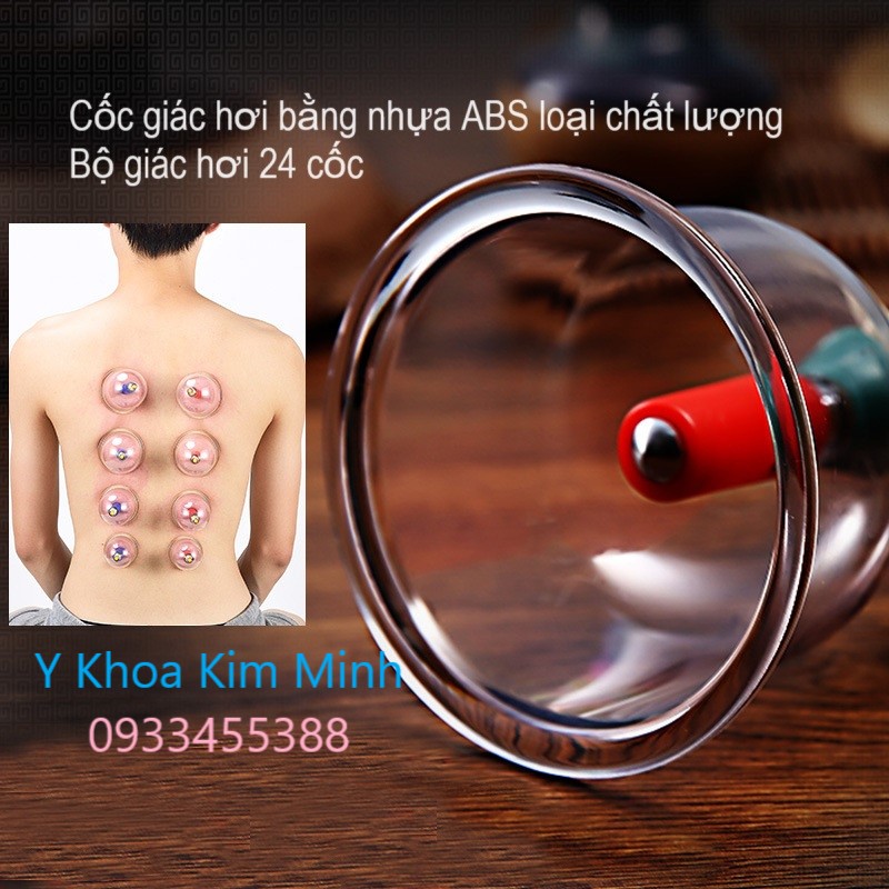 Cốc giác hơi nhựa ABS