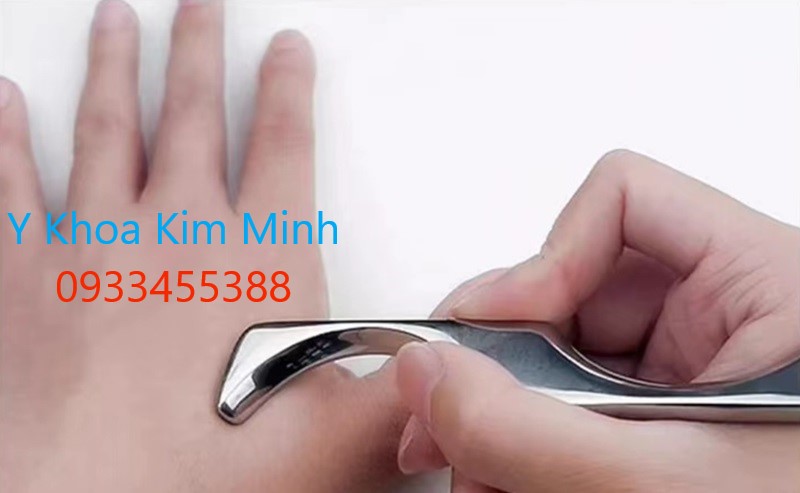 Dao giải huyệt đạo, dao móc huyệt đạo, dụng cụ giải cơ huyệt đạo chi tay chân