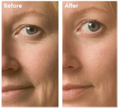 Hiệu quả cao khi sử dụng m&aacute;y phun oxy thẩm mỹ 