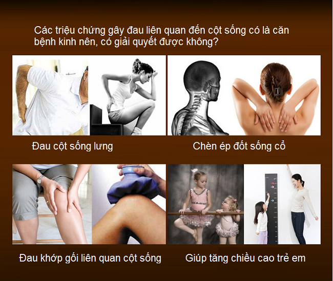 Các bệnh liên quan gây ra từ đau cột sống lưng cổ - Y Khoa Kim Minh Cách chữa bệnh đau cột sống, thoát vị đĩa đệm hiệu quả bằng giường kéo cột sống KM325 - Y khoa Kim Minh