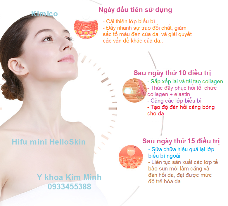 May hifu mini HelloSkin giup ban tre hoa da, cang bong chong nhan cong nghe SMAS Kim Minh 0933455388