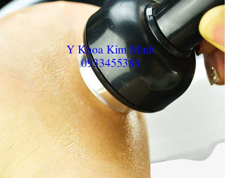 Cach su dung vien hut chi dao thai doc to cho da Y Khoa Kim Minh