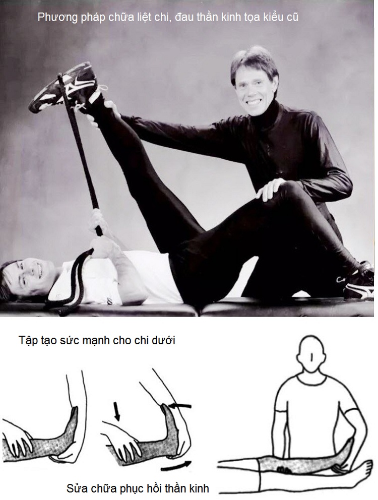 Cách chữa đau thần kinh tọa kiểu cũ - Y khoa Kim Minh