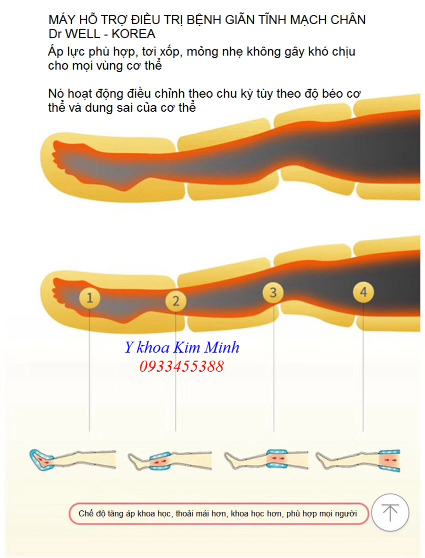 Cách thức điều trị bệnh giãn tĩnh mạch của máy Dr Well - Y khoa Kim Minh 0933455388