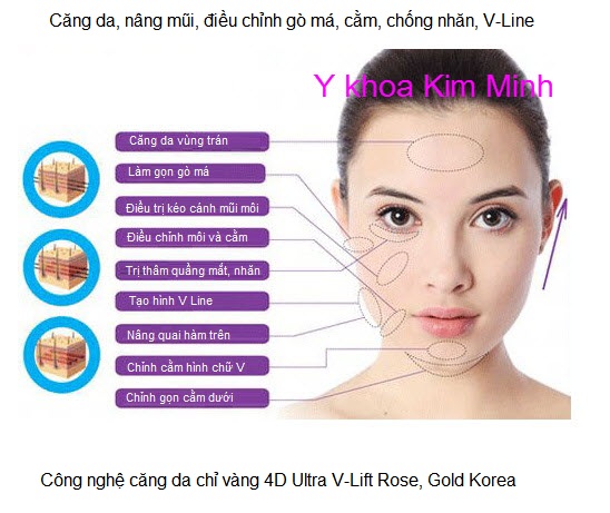 C&ocirc;ng ty b&aacute;n chỉ v&agrave;ng căng da 4D Ultra V-Lift Gold Rose 25mm, 30mm, 50mm, 80mm Y Khoa Kim Minh