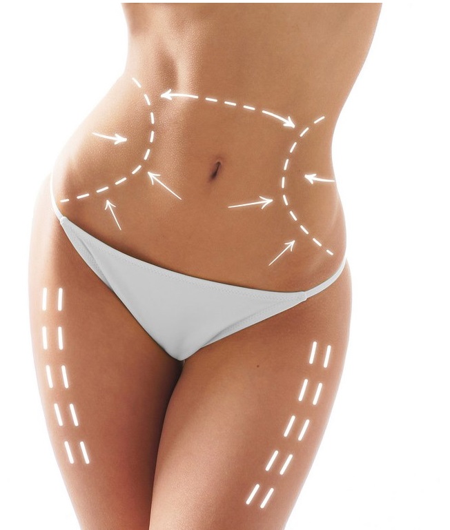 Cang da tieu mo bung bang chi Tri Lipo Cog Korea Ultra Vlift Y Khoa Kim Minh