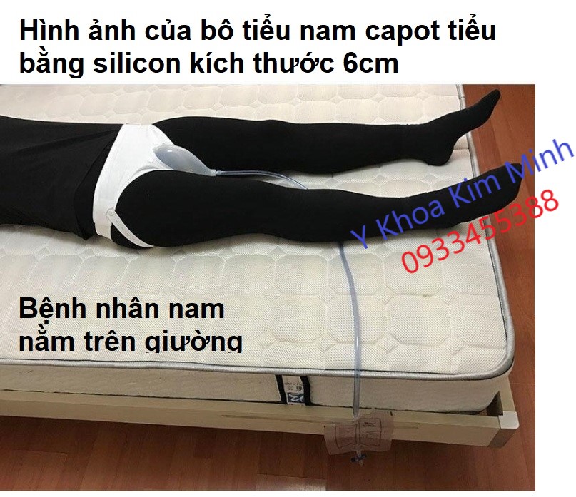 Capot tieu nam
