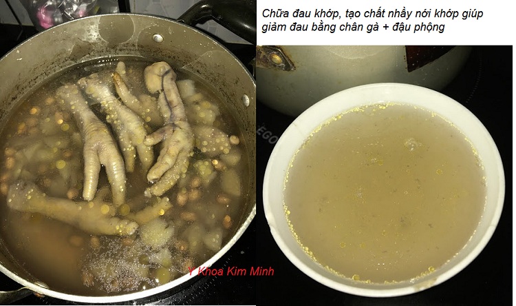 Chua dau khop, dau nhut toan than bang chan ga + dau phong lac + dau den xanh long Y khoa Kim Minh