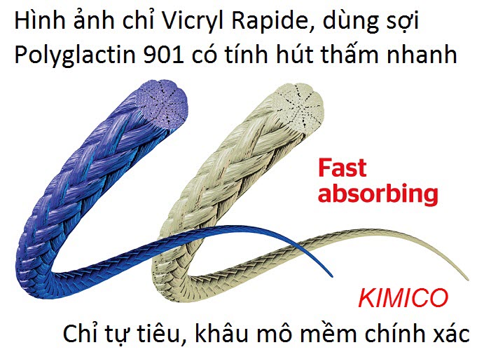 Tính năng của chỉ khâu phẫu thuật Vicryl Rapide 6-0 V32H