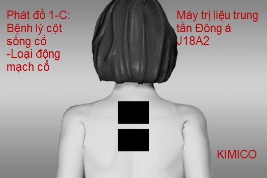 M&aacute;y điều trị trung tần chữa trị lối loạn động mạch cổ J18A2 Đ&ocirc;ng &Aacute; Y Khoa Kim minh