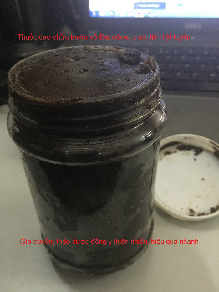 Dia chi ban thuoc chua benh buou co gia truyen cuc ky hieu qua Y Khoa Kim Minh