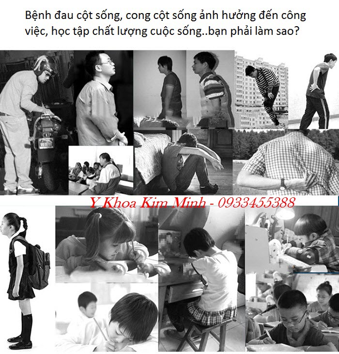 Chua benh dau cot song, cong cot song o dau tai Tp Ho Chi Minh hieu qua - Y khoa Kim Minh