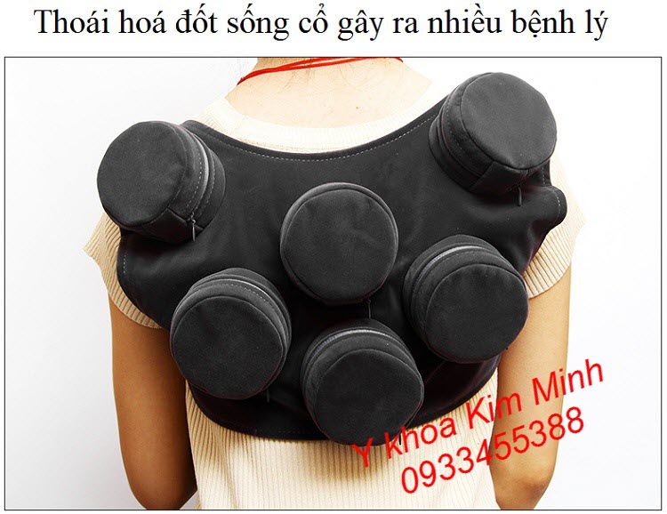 Chữa bệnh thoái hoá đốt sống cổ, đốt sống ngực có dễ dàng không khi dùng đai xông ngải cứu 6 bầu đồng - Y Khoa Kim Minh