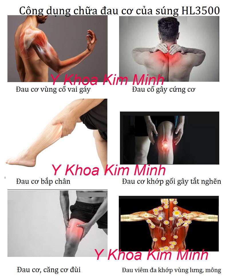 Công dụng của súng nắn xương HL3500 trị đau viêm cơ khớp