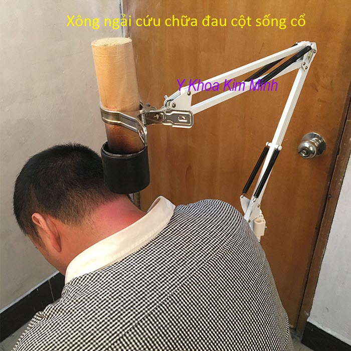 Chua dau nhuc cot song co bang cach xong nhang ngai cuu - Y khoa Kim Minh