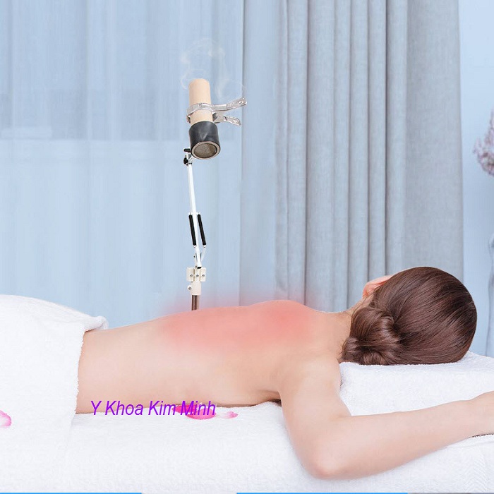 Chua tri dau lung, dau cot song bang den xong ngai cuu - Y Khoa Kim Minh