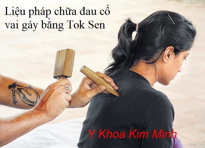 Trị đau cổ vai gáy bằng bộ gõ Tok Sen - Y Khoa Kim Minh