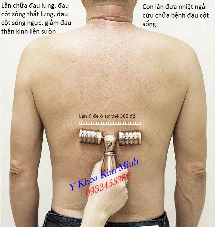 Con lăn ngải cứu bằng đồng chữa bệnh thoát vị đĩa đệm, đau cột sống, thoái hoá đốt sống lưng cổ - Y Khoa Kim Minh