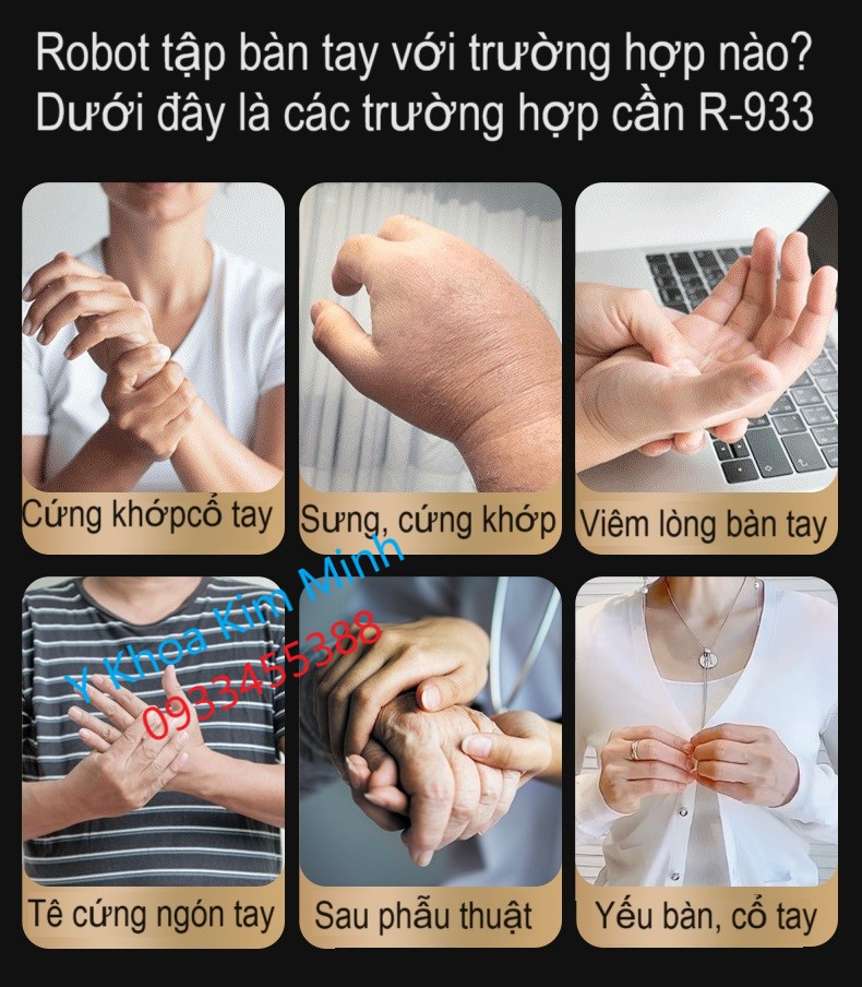 Phục hồi chức năng vật lý trị liệu bàn tay yếu đau khớp