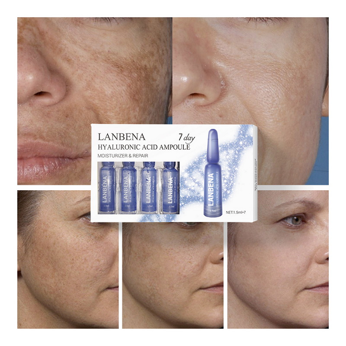 Công dụng chữa thâm nám, giữ ẩm, căng bóng da của huyết thanh HA Lanbena Ampoule - Y khoa Kim Minh