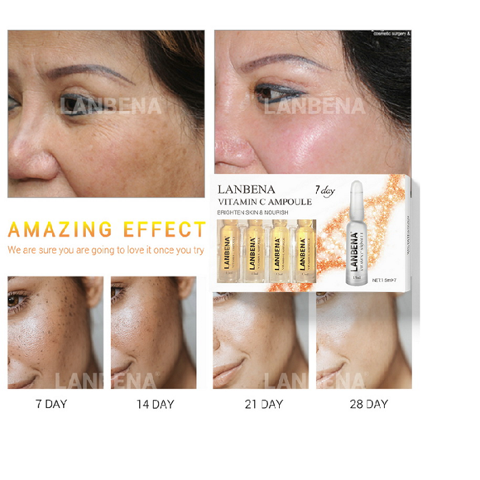 Công dụng của huyết thanh Vitamin C Lanbena giúp giữ ẩm, làm mịn, giảm thâm nám sạm, giảm tàn nhang, làm trắng mịn da - Y Khoa Kim Minh
