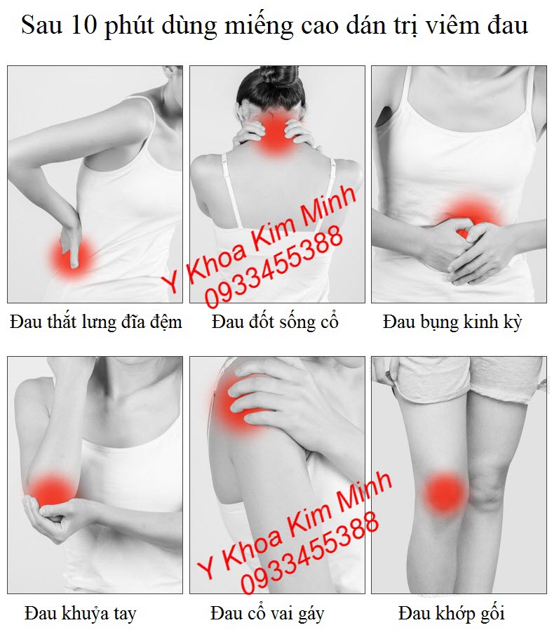 Công dụng của miếng dán trị viêm đau cơ xương khớp, đau cột sống lưng cổ, đau khớp gối