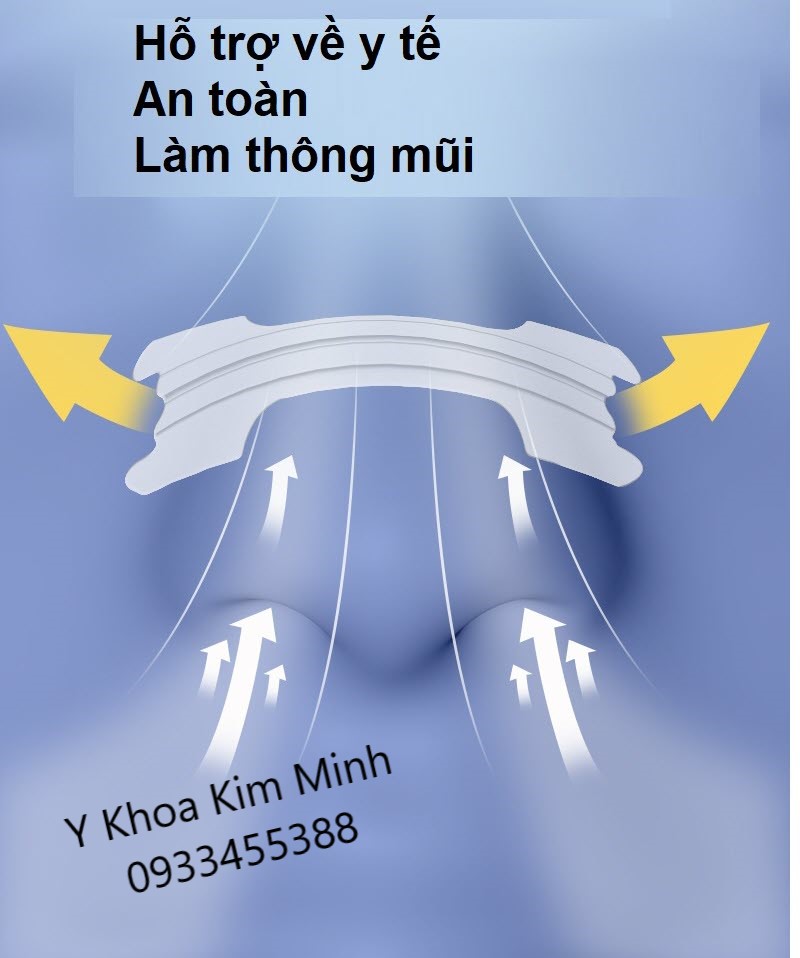 Băng dán mũi giúp loại bỏ chứng nghẹt mũi khi ngủ