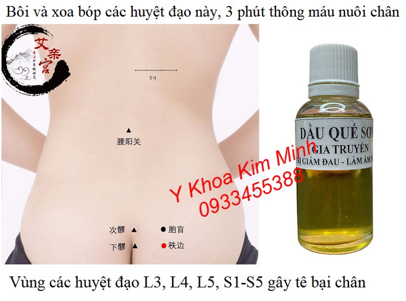 Chữa đau thần kinh toạ, chèn tì đè cột sống L3, L4, L5 gây ra, sau bôi xoa bóp 2-3 phút giảm tức thì - Y khoa Kim Minh Tinh dầu quế sơn chữa tê bại chân do bệnh thần kinh toạ, chèn cột sống L3, L4, L5, chữa thoá hoá đốt sống cổ do tắt nghẽn máu bởi tì đè gây nên - Y khoa Kim Minh