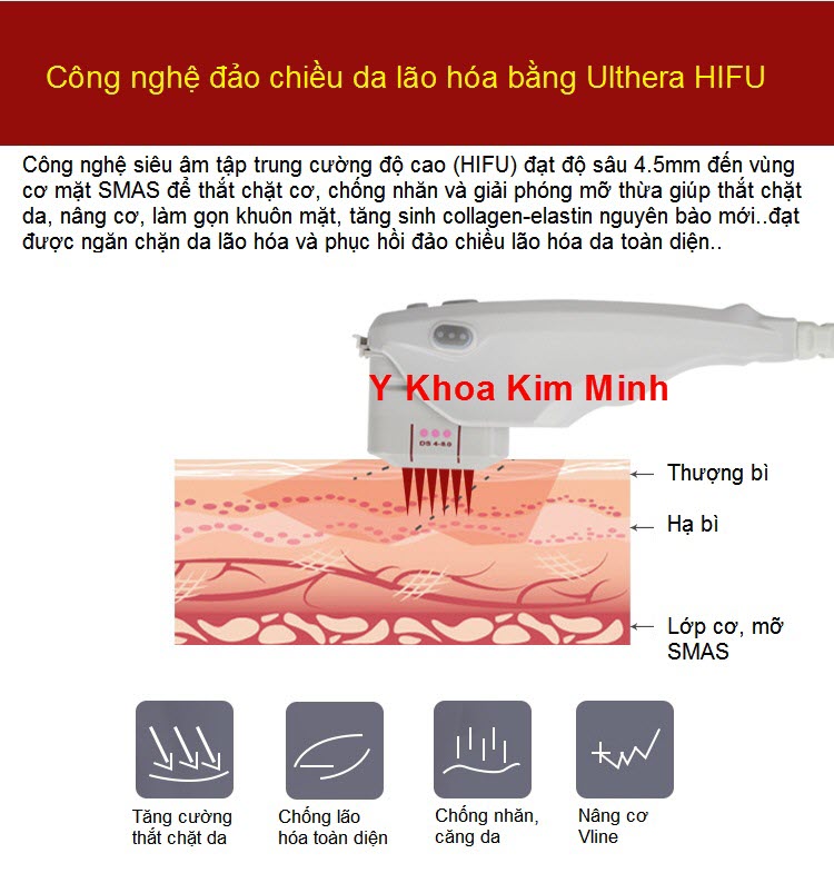 Công nghệ HIFU Ulthera SMAS - Y Khoa Kim Minh Cong nghe may HIFU Ultherap SMAS V-258 - Y Khoa Kim Minh