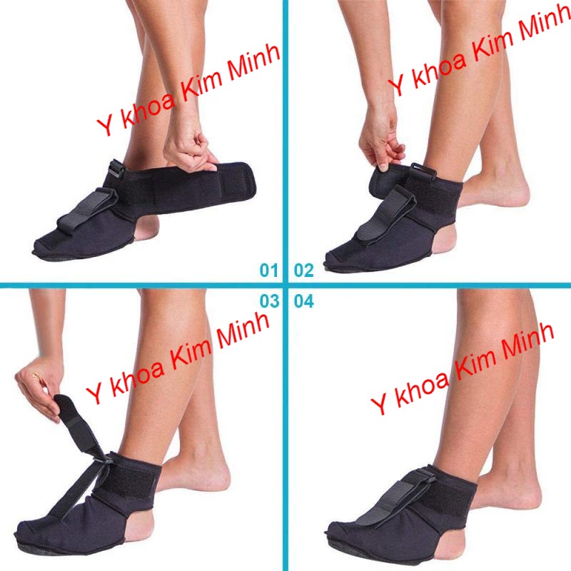 Hướng dẫn sử dụng đai nẹp cổ chân, bó ổn định mắt cá chân bị chấn thương