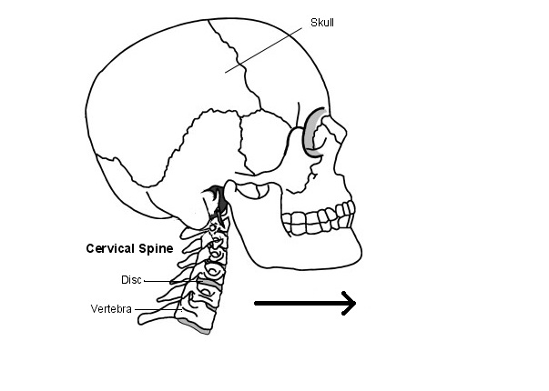 Đau cột sống cổ