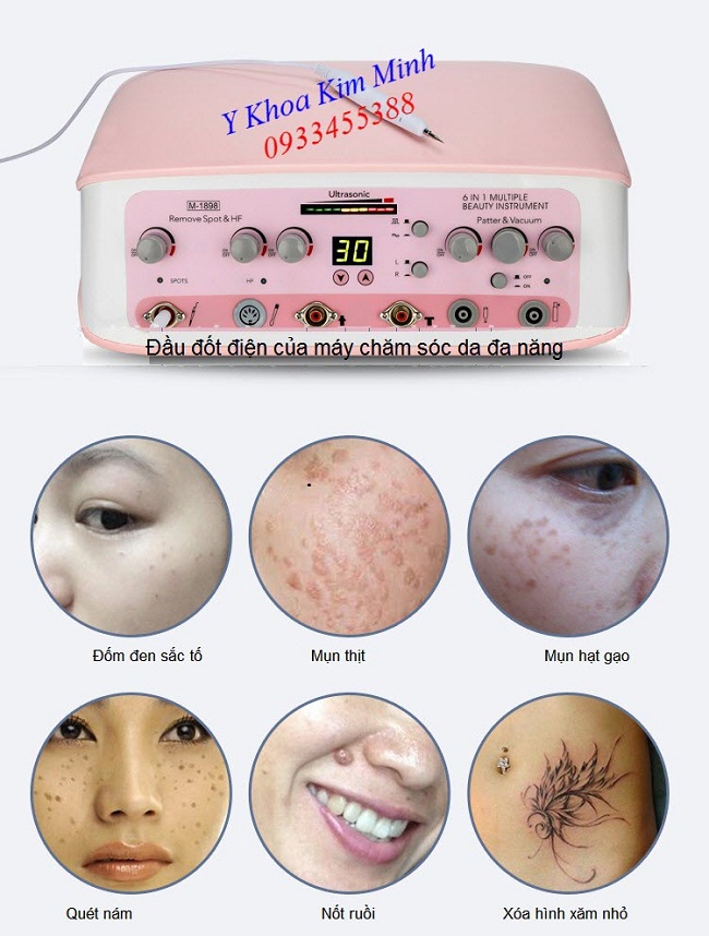 Đầu đốt điện của máy chăm sóc da mặt đa năng - Y Khoa Kim Minh