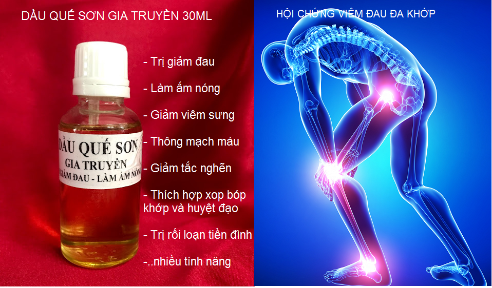 Dầu Quế Sơn chữa trị đau đa khớp toàn thân - Y khoa Kim Minh Dầu Quế Sơn chữa trị đau đa khớp toàn thân - Y khoa Kim Minh 0933455388