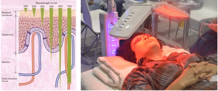 Den anh sang sinh hoc 7 mau Bioled dieu tri da toan than