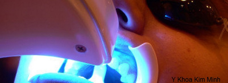 Dia chi ban den laser tay trang rang TW-4 Y Khoa Kim Minh