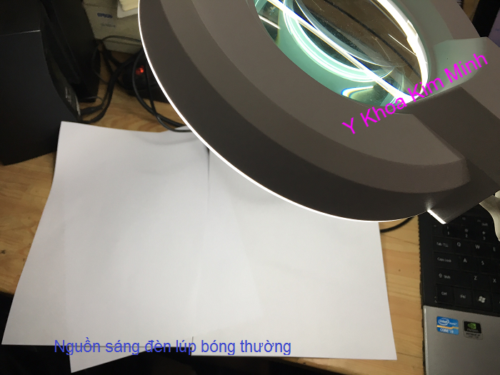 Den lup soi da lay mun thong thuong Y Khoa Kim Minh