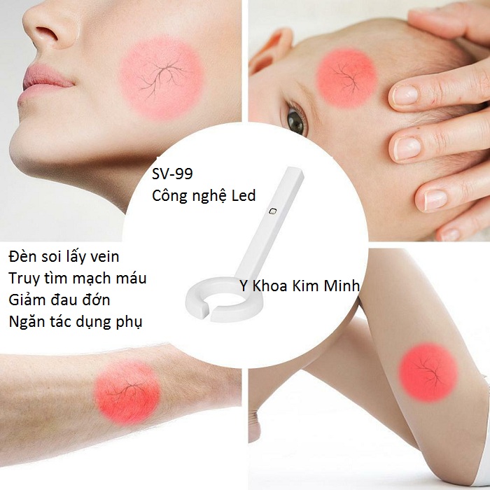 Đèn tìm mạch máu SV-99 Đèn soi mạch máu, truy tìm tĩnh mạch lấy vein SV-99 bán tại Tp Hồ Chí Minh - Y khoa Kim Minh