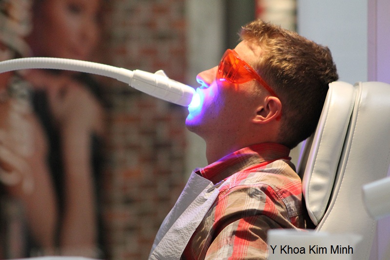 Cong ty Kim Minh ban den laser tay trang rang nhap khau