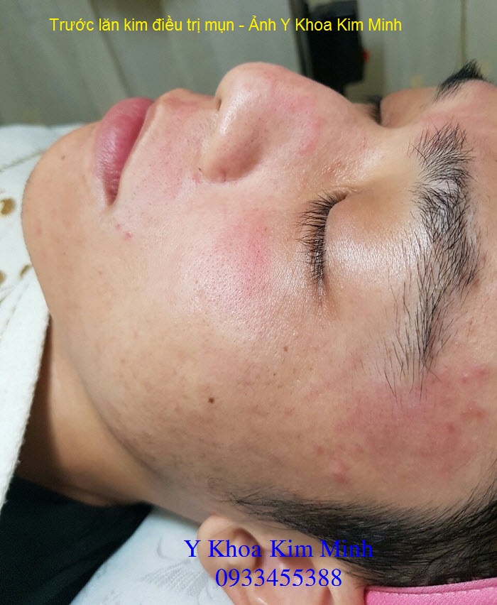 Te bao goc tao xoan do Nhat Ban Y Khoa Kim Minh